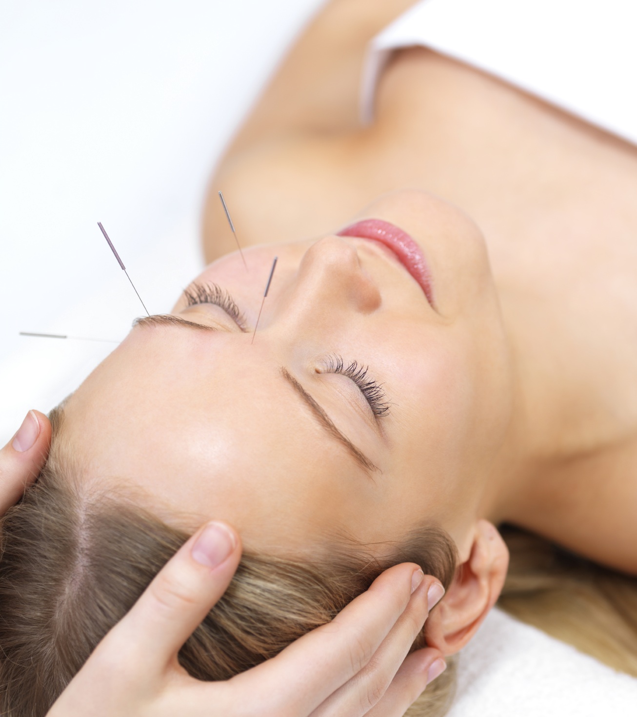 Acupuncture therapy 