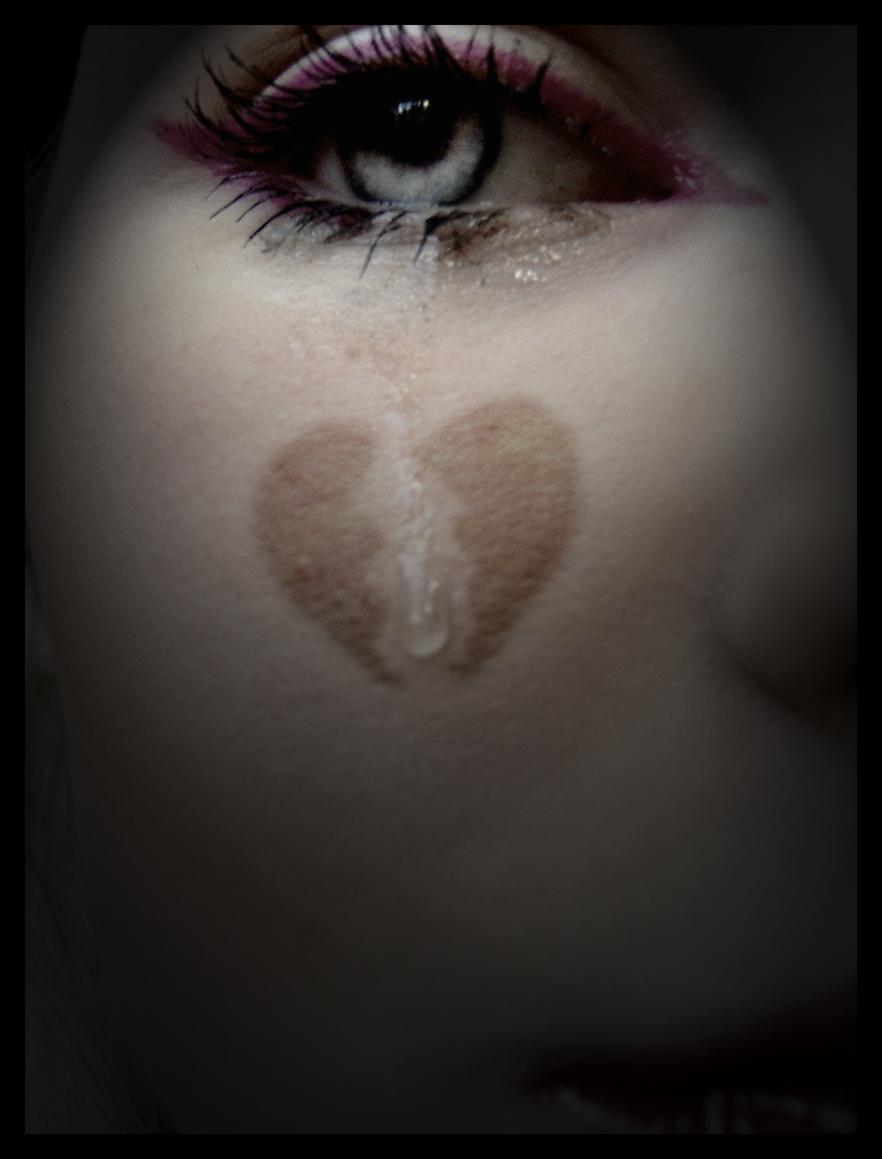Broken Heart
