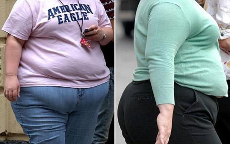 Obesity